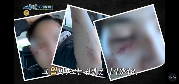 [서울=뉴시스]'실화탐사대' 피해자. 2022.08.18. (사진='실화탐사대' 유튜브 캡처) photo@newsis.com*재판매 및 DB 금지 *재판매 및 DB 금지