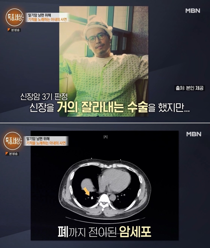 [서울=뉴시스] '특종세상' 영상 캡처 . 2022.08.19. (사진= MBN 제공) photo@newsis.com*재판매 및 DB 금지 *재판매 및 DB 금지