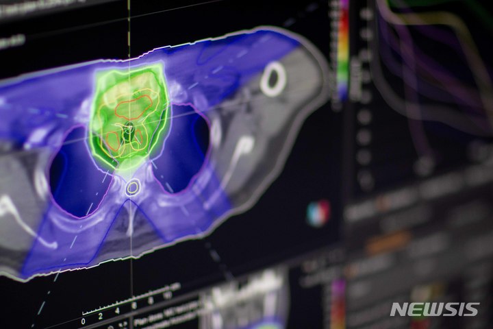 [서울=뉴시스]중입자치료를 위한 치료계획시스템(TPS) 구동 화면. (사진= 서울대병원 제공) 2022.08.25
