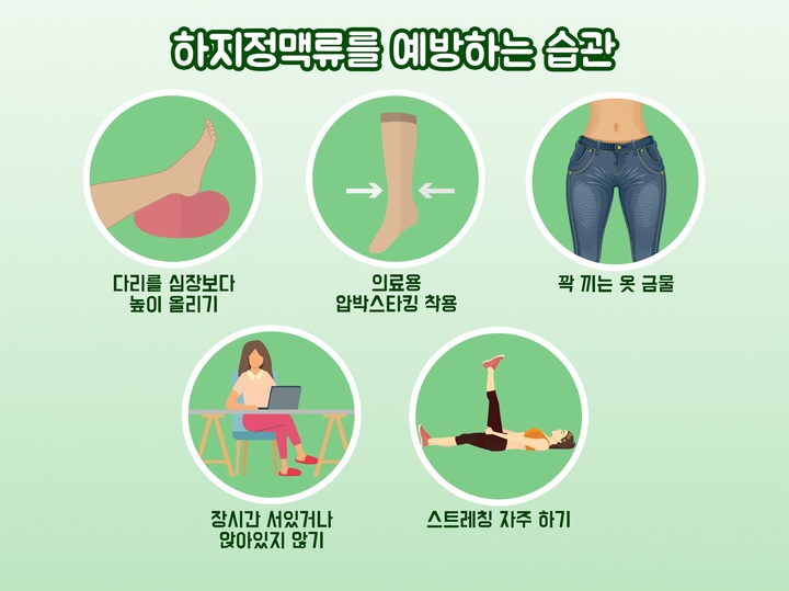 하지정맥류 예방법(출처 : 나누리병원) *재판매 및 DB 금지