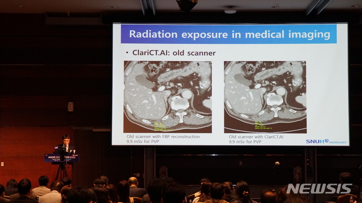 [서울=뉴시스]이동호 서울대병원 영상의학과 교수가 인공지능(AI) 기술을 결합해 기존 대비 3분의1 방사선량만을 사용하는 저선량 컴퓨터단층촬영(CT)으로 간암을 충분히 진단할 수 있다는 사실이 다국적 임상시험 결과 확인됐다고 밝혔다. (사진= 백영미 기자) 2022.09.20