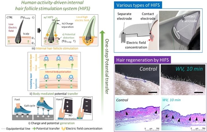 자가발전 모낭 자극 시스템의 기전 *재판매 및 DB 금지