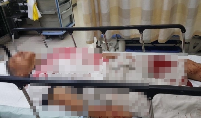 [서울=뉴시스] 전재훈 기자 = 29일 경찰에 따르면 서울 영등포경찰서는 특정범죄가중처벌에관한 법률위반(도주치상) 혐의를 받는 50대 남성 A씨를 체포해 조사 중이다. (사진=온라인 커뮤니티 캡쳐) 2022.09.29. *재판매 및 DB 금지