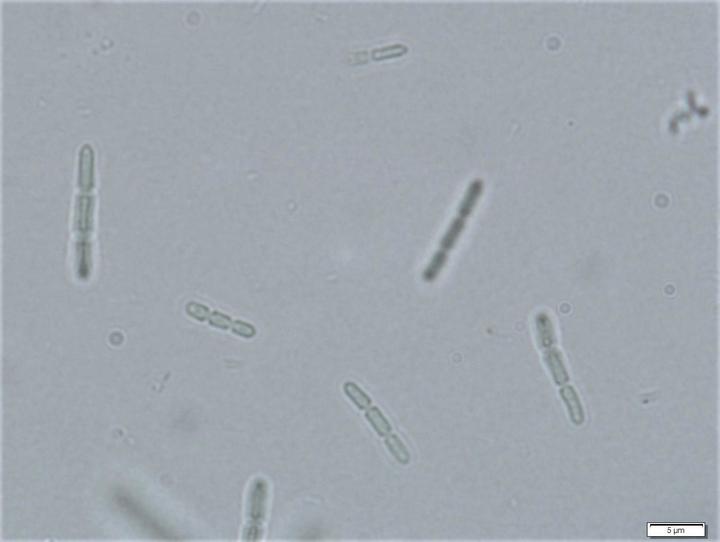 [서울=뉴시스]자생 미세조류 슈드아나배나 뮤시콜라 지오0704(Pseudanabaena mucicola GO0704)의 형태(사진=국립생물자원관 제공) *재판매 및 DB 금지 *재판매 및 DB 금지