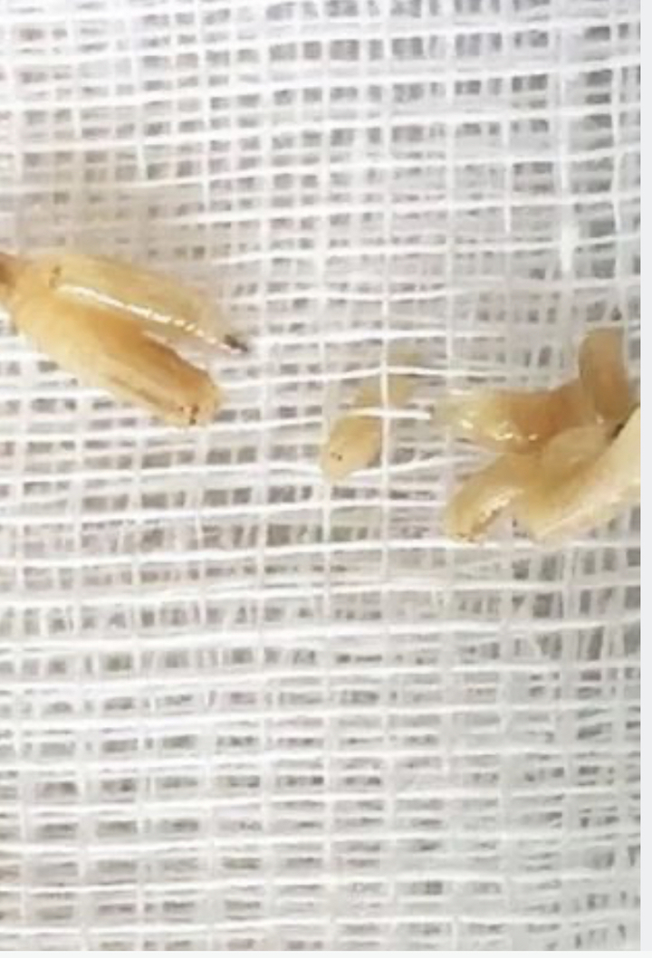 [서울=뉴시스] 귀 통증으로 병원 찾은 남성의 귀 안에서 살을 파먹는 구더기가 발견됐다고 8일(현지시간) 미러가 보도했다. <출처 : 영국 미러 홈페이지 캡처> 2022.12.09. *재판매 및 DB 금지