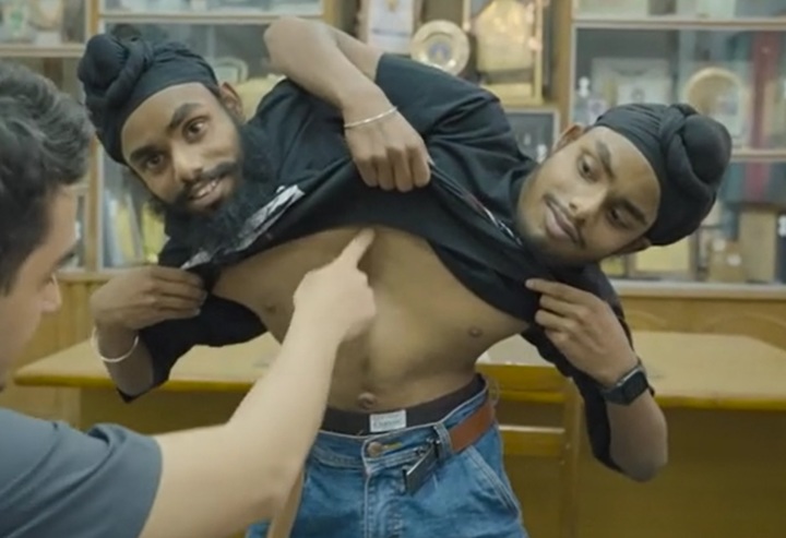 [서울=뉴시스] 간과 담낭, 다리, 비장을 공유한 채 태어난 소나, 모나 형제가 자신들의 일상을 공유했다 (사진출처: 데일리메일 영상 캡처) 2022.12.12. *재판매 및 DB 금지