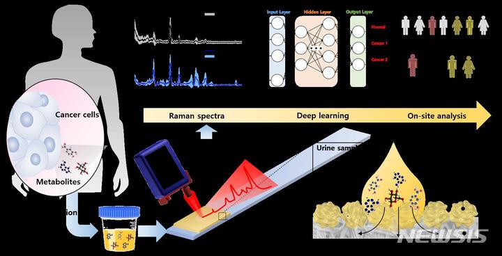 [창원=뉴시스] 홍정명 기자=한국재료연구원 정호상 박사 연구팀이 포스텍 노준석 교수, 경희대 의과대학 최삼진 교수와 공동연구로 개발한 '소변 내 대사체 광신호 증폭을 위한 스트립 형 소변 센서와 현장 암 진단 기술’의 모식도.(그림=한국재료연구원 제공) 2023.01.25. photo@newsis.com