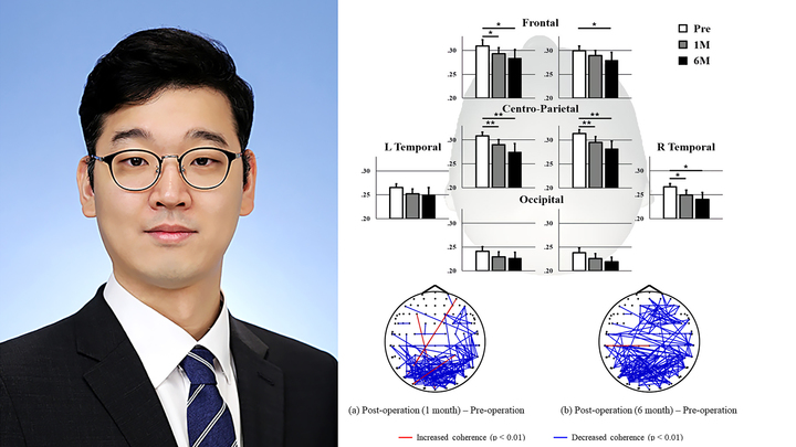 [광주=뉴시스] 류형근 기자 = 전남대학교는 헬스케어메디컬공학부 디지털헬스케어전공 김도원 교수팀(사진)·연세대 세브란스병원 정신건강의학과·명지병원 공동 연구팀의 '고집적 초음파뇌수술(MRgFUS) 신경생리학적인 변화 규명 논문'이 정신의학분야 상위 5% 논문지인 '아시안 저널 오브 사이키아트리(Asian Journal of Psychiatry·IF=13.890)에 게재됐다고 31일 밝혔다. (사진=전남대학교 제공). photo@newsis.com *재판매 및 DB 금지