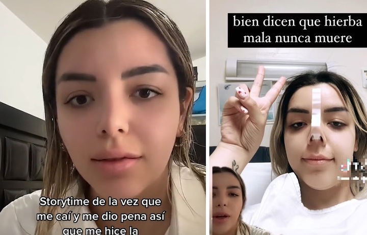 [서울=뉴시스] 계단에서 굴러떨어진 에스테파니아 산체스(24, 사진)는 민망함을 모면하기 위해 '기절한 척'을 하다 병원에 실려가 담석을 제거하게 됐다 (사진출처: 뉴욕포스트 영상, 소셜미디어 캡처) 2023.02.02. *재판매 및 DB 금지