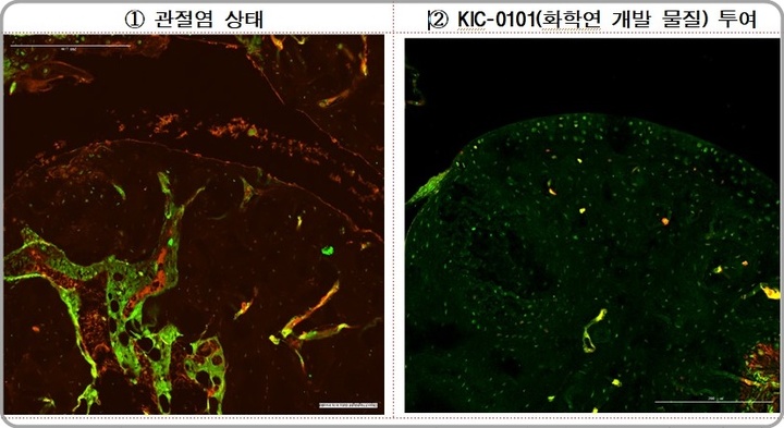 [대전=뉴시스] 류마티스 관절염 동물모델에 KIC-0101 투여하면 관절염 조직(왼쪽)에서 빨간색 및 연두색의 염증단백질이 감소하고 연골세포 수 회복 및 염증으로 손상된 조직이 복구됐다(오른쪽). *재판매 및 DB 금지