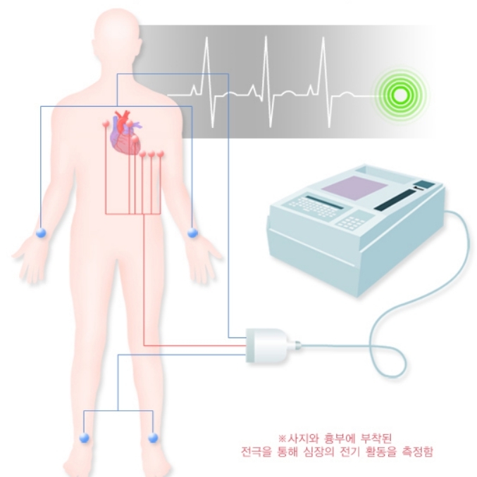 [서울=뉴시스] 최근 디지털 헬스케어가 발전하면서 심전도 판독 역시 AI 등 첨단 기술을 결합한 서비스들이 나오고 있다. 사진은 심전도 검사를 위한 전극의 위치.(사진=질병관리청 제공) *재판매 및 DB 금지