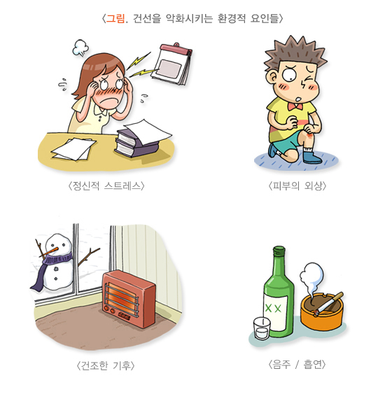 [서울=뉴시스] 29일 의료계에 따르면 겨울이면 피부 각질 등이 심해지는 마른 버짐(건선) 환자가 늘어난다. 사진은 건선을 악화시키는 환경적 요인들. (사진=질병관리청 제공) 2024.01.29. photo@newsis.com *재판매 및 DB 금지