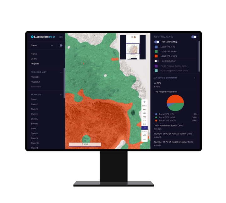 [서울=뉴시스] 7일 의료 인공지능(AI) 기업 루닛은 AI 병리분석 솔루션 ‘루닛 스코프 PD-L1’의 미국시장 진출을 위한 클리아랩 실험실 자체개발 진단검사(LDT)에서 유효성 검증을 완료했다고 밝혔다. (사진=루닛 제공) *재판매 및 DB 금지