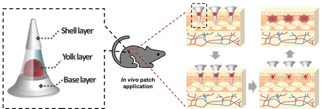 [서울=뉴시스] Egg microneedle의 구성 요소 및 투여 원리 (사진=주빅 제공) *재판매 및 DB 금지