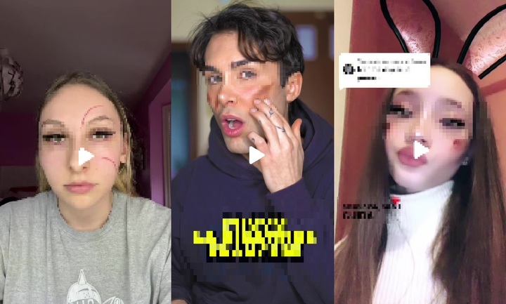 온라인 영상 플랫폼 상에서 몸에 흉터를 내는 챌린지를 하고 있는 해외 청소년들.(출처 : 틱톡 영상 캡처) *재판매 및 DB 금지