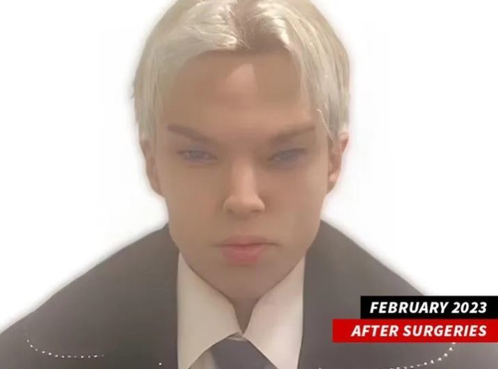 12차례의 성형수술을 받은 세인트 본 콜루치. (캡처=TMZ 인스타그램) *재판매 및 DB 금지