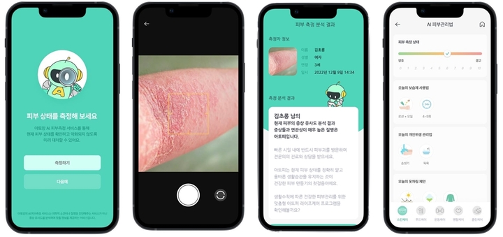 [서울=뉴시스] 아토맘 'AI 피부건강측정서비스' 서비스 화면. (사진=아토맘코리아 제공) 2023.05.12. photo@newsis.com *재판매 및 DB 금지