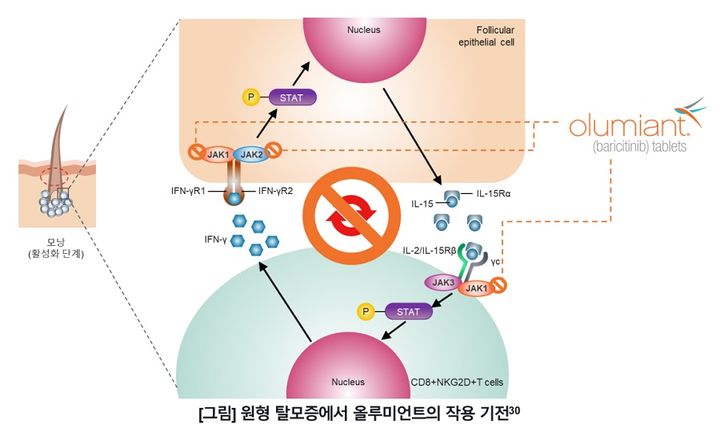 [서울=뉴시스] 원형 탈모증에서 올루미언트의 작용 기전. (사진=한국릴리 제공) 2023.06.22. photo@newsis.com&nbsp;&nbsp; *재판매 및 DB 금지
