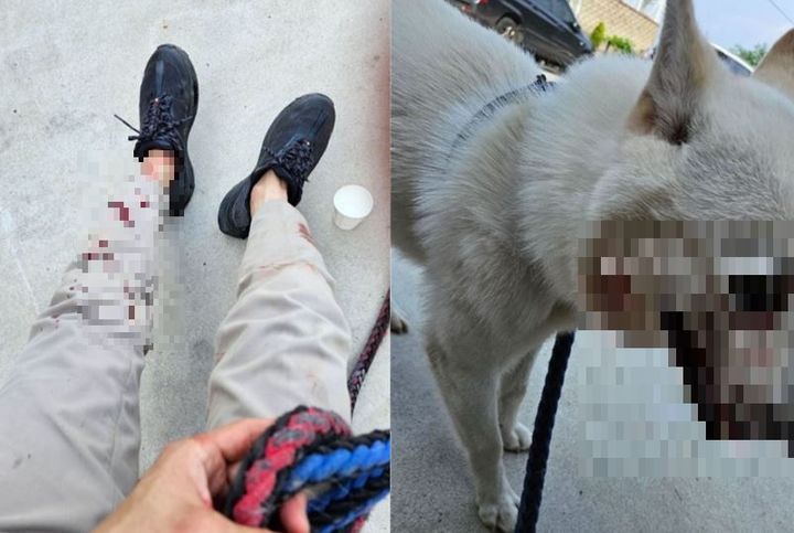 맹견 '핏불'에 공격당해 피투성이가 된 주인과 진돗개 (사진=온라인 커뮤니티 '소울라운지' 켑쳐) *재판매 및 DB 금지