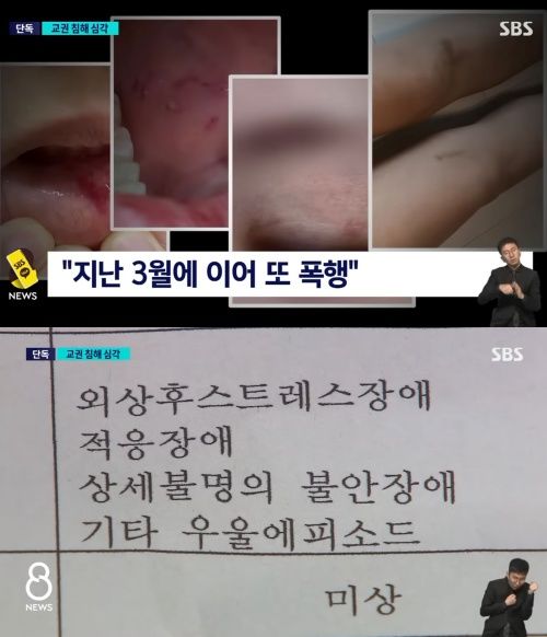 (사진='SBS뉴스' 캡처본) *재판매 및 DB 금지