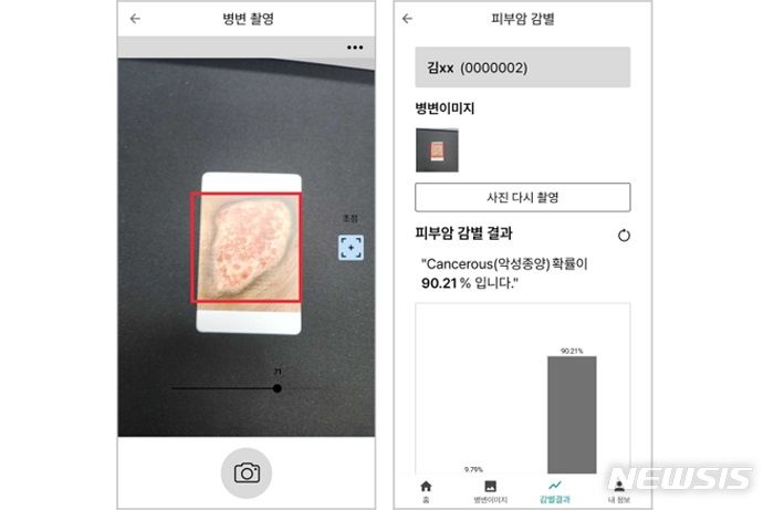 [서울=뉴시스] 디지털헬스 기업 라이프시맨틱스가 피부암 진단 보조를 돕는 소프트웨어 유효성 평가를 위한 임상시험에 돌입했다. (사진=라이프시맨틱스 제공) 2023.08.02. photo@newsis.com