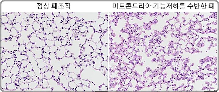 [대전=뉴시스] 미토콘드리아 기능 저하에 따른 쥐의 폐조직 변화. 미토콘드리아 기능저하를 가진 쥐의 폐조직은 비정상적인 상태의 폐포조직을 보인다.(사진=노스웨스턴대 한승혜 교수 제공) *재판매 및 DB 금지