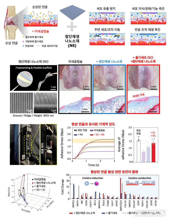 [광주=뉴시스] 전남대학교 김장호 교수팀 개발 '첨단 재생 나노소재 기술 이용, 손상된 무릎 연골을 치료법' 모식도. (사진=전남대학교 제공). photo@newsis.com *재판매 및 DB 금지