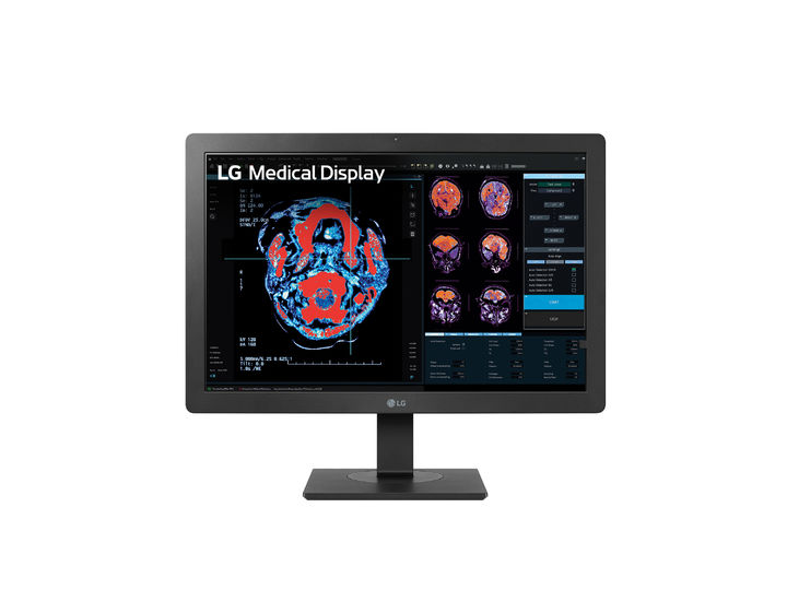 [서울=뉴시스] 임상용과 진단용으로 활용가능한 LG전자의 의료용 모니터. (사진=LG전자) 2023.12.13. photo@newsis.com  *재판매 및 DB 금지