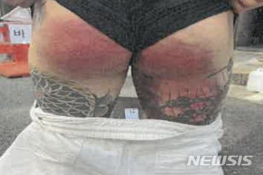 [인천=뉴시스] '빠따폭행' 당한 폭력조직원. (사진=인천지검 제공)