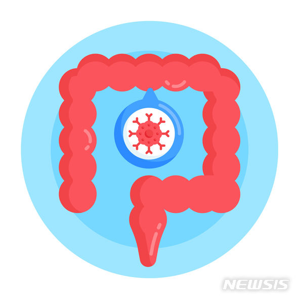 [서울=뉴시스]조기 대장암에서 생존율에 영향을 미치는 주요인인 림프절 전이 발생에 영향을 미치는 위험인자를 밝혀내 수술까지 필요한 조기 대장암 환자를 사전에 가려낼 수 있게 됐다. (이미지= 게티이미지뱅크 제공) 2024.01.10. photo@newsis.com. 