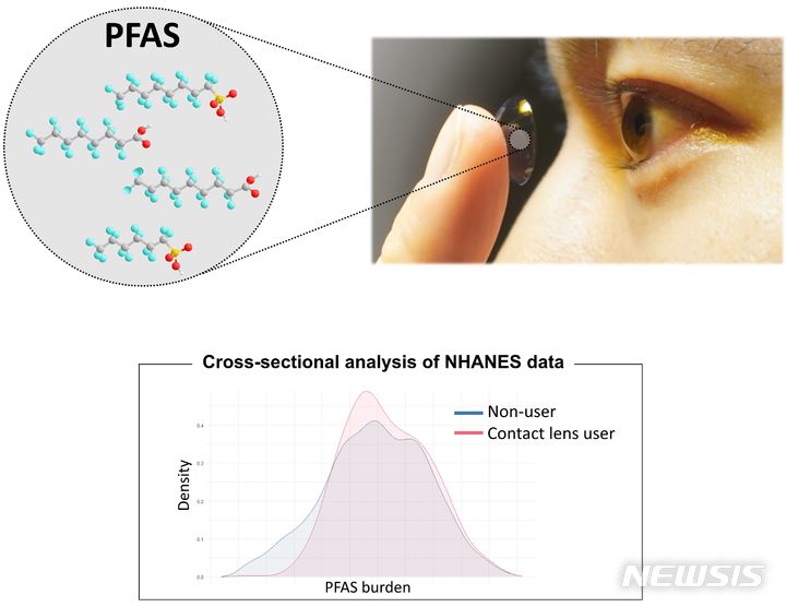 [서울=뉴시스]콘택트렌즈 사용자는 혈중 과불화화합물(Per- and Poly Fluoroalkyl Substances·PFAS)의 총 체내 축적 유해물질이 1.2배 높다는 연구 결과가 나왔다. 혈중 과불화화합물이란 아웃도어 의류, 식품 포장재, 종이빨대, 프라이팬, 화장품 등에 사용되는 방수코팅제 물질군으로, 화학적으로 잘 분해되지 않고 환경과 생체 내 오래 잔류해 ‘사라지지 않는 화학물질’로 불린다. (사진= 고려대 안암병원 제공) 2024. 01.10. photo@newsis.com. 