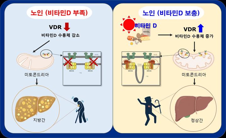 [세종=뉴시스] 질병관리청 국립보건연구원이 비타민D를 충분히 섭취하면 나이가 들면서 발생하는 비알콜성 지방간을 예방하는 기전을 증명했다. (자료=국립보건연구원 제공) 2024.01.16. photo@newsis.com *재판매 및 DB 금지