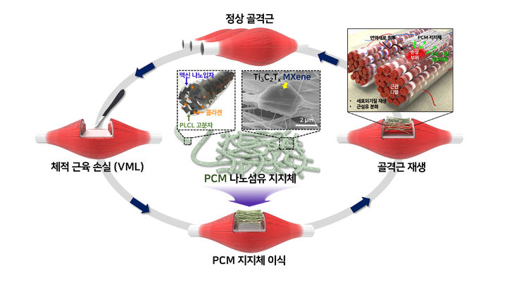 [부산=뉴시스] 맥신 나노섬유 지지체를 활용한 체적 근육 손실 재생 모식도. (그림=부산대 제공) *재판매 및 DB 금지