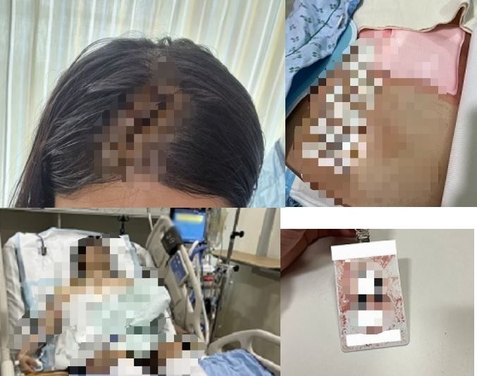 [서울=뉴시스]자신을 만나주지 않는다며 스토킹하던 전 남자친구가 직장에 찾아와 휘두른 흉기에 큰 부상을 당한 피해자의 가족이 '보복 범죄'가 두렵다고 올린 글이 화제가 되고 있다. (사진=온라인 커뮤니티 '네이트판' 캡처) *재판매 및 DB 금지