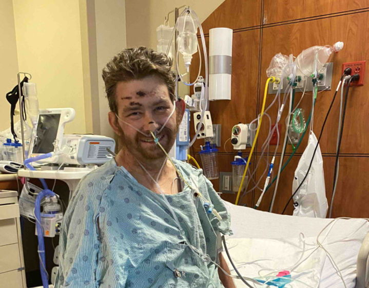 [서울=뉴시스] 미국에서 한 남성이 셀프 왁싱 중 불결한 환경 때문에 세균 감염으로 혼수 상태에 빠진 사연이 전해졌다. 사진은 사연의 주인공 스티븐. <사진캡처=Gofundme> 2024.3.22. *재판매 및 DB 금지