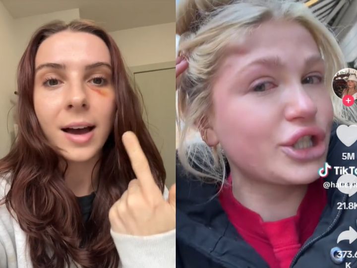 [서울=뉴시스] 뉴욕에서 여성을 상대로 한 '묻지마 폭행' 피해자들이 소셜미디어에 피해 사실을 폭로하는 영상을 게시했다. 이에 뉴욕 경찰은 성명문을 발표했다. (사진=tiktok 캡처) *재판매 및 DB 금지