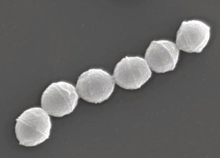 [서울=뉴시스] 30%대 이상의 치명률을 가진 것으로 알려진 연쇄상구균 독성쇼크증후군(STSS)이 일본에서 도쿄를 중심으로 빠르게 확산하고 있다. 사진은 '연쇄상구균 독성쇼크중후군'의 원인이 되는 A군 연쇄상구균 (사진=일본 국립감염병연구소) *재판매 및 DB 금지