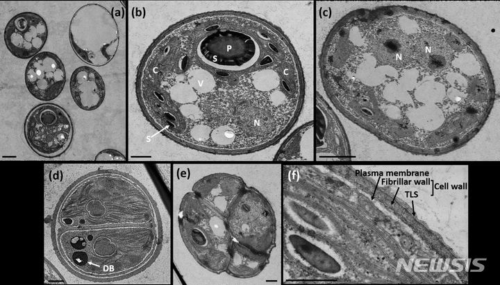 [서울=뉴시스] 그라시엘라 이머소니의 GEGS21 투과전자현미경 사진.