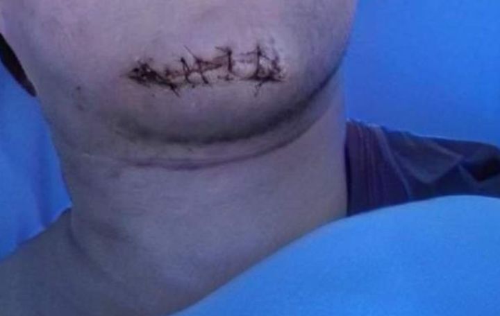 캄보디아를 여행하던 한국인이 사고를 당해 귀국하지 못하고 불법체류자로 전락할 위기에 빠졌다는 소식이 알려졌다(사진= 온라인 커뮤니티 갈무리) *재판매 및 DB 금지