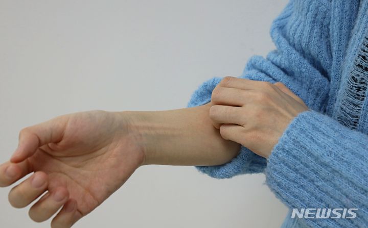 [서울=뉴시스]바이러스성 피부질환인 사마귀는 사람유두종 바이러스(HPV)가 피부 표면에 감염돼 발생한다. 육안으로는 티눈이나 굳은살 등과 구분하기 어려워 다른 부위로 옮겨지기 전 조기에 치료하는 것이 중요하다. (사진= 고려대 안암병원 제공) 2024.04.17. photo@newsis.com. 