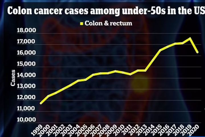 [서울=뉴시스] 사진은 50세 미만 미국인의 대장암 발병률 추이 그래프. (사진= 데일리메일 캡처) *재판매 및 DB 금지
