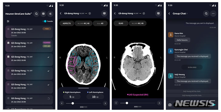 [서울=뉴시스] 21일 뇌신경 질환 전문 의료 AI 기업 휴런은 비조영 컴퓨터단층촬영(CT) 기반 응급 뇌졸중 선별 인공지능 솔루션 '휴런 스트로케어 스위트(Heuron StroCare Suite)'의 모바일 어플리케이션을 출시했다고 밝혔다. (사진=휴런 제공) 2024.06.21. photo@newsis.com