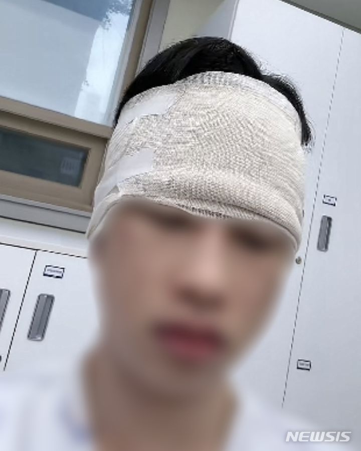 [인천=뉴시스] 폭행 당한 틱톡커. (사진=온라인 커뮤니티 캡처) 2024.07.02. photo@newsis.com