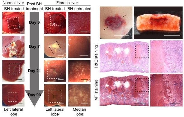 [서울=뉴시스] 히스토트립시 간경화 동물 실험 결과 (사진=경희대) *재판매 및 DB 금지