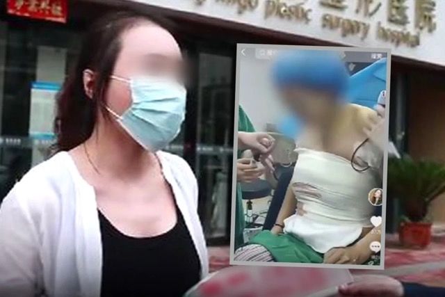 [서울=뉴시스] 16일 홍콩 사우스차이나모닝포스트(SCMP)에 따르면 지난 1월 가오라는 성을 가진 여성 A씨는 중국 중부 허난성의 한 성형외과 병원에서 가슴 확대 수술을 받았다. (사진=SCMP 보도 갈무리)