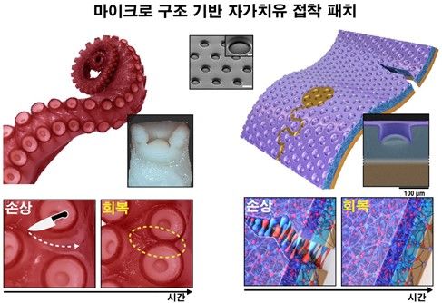 [서울=뉴시스] 문어의 빨판구조와 치유 성능을 모사한 패치 (사진=성균관대 제공) *재판매 및 DB 금지