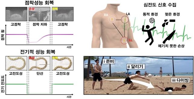 [서울=뉴시스] 생체모사 자가치유 점착 패치의 심전도 신호 수집 응용 (사진=성균관대 제공) *재판매 및 DB 금지