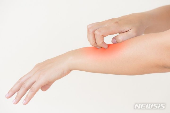 日 매독 감염자 연간 1만3000명…"불특정 다수와의 성적 접촉 때문일 수 있어"