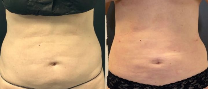 [서울=뉴시스] 미국에서 60대 이상의 여성들이 미용 성형을 하는 사례가 증가하고 있다는 보도가 나왔다. (사진= Paul Jarrod Frank 제공) *재판매 및 DB 금지