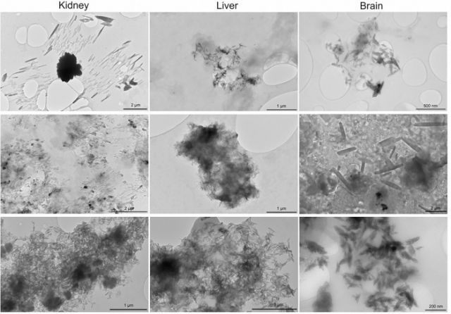 [서울=뉴시스] 인간의 신장(왼쪽), 간(중앙), 뇌(오른쪽) 샘플에서 추출한 고체 나노입자 투과전자현미경 이미지. (사진=미국 국립보건원) *재판매 및 DB 금지